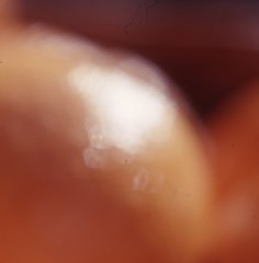 Orangenhaut Tele Detail.jpg